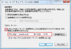 IE7: ローカル エリア ネットワーク (LAN) の設定